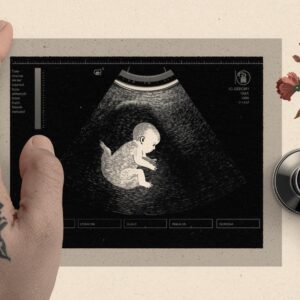 Hamilelikte 23. Hafta