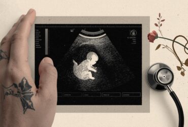 Hamilelikte 23. Hafta